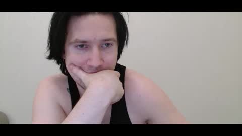 vitiligoboyy online show from March 3, 2026, 1:12 am